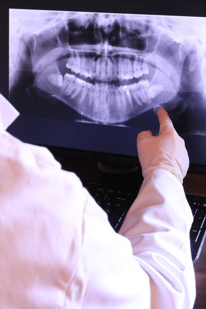 Best Chipped Tooth Repair Near Me  in Violet, LA