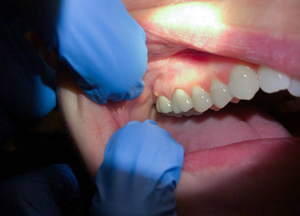 Best Emergency Dentist Open Today  in Violet, LA