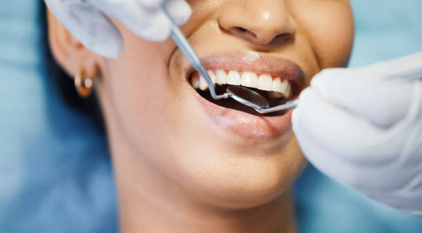 Best Dentist for Severe Toothache  in Violet, LA