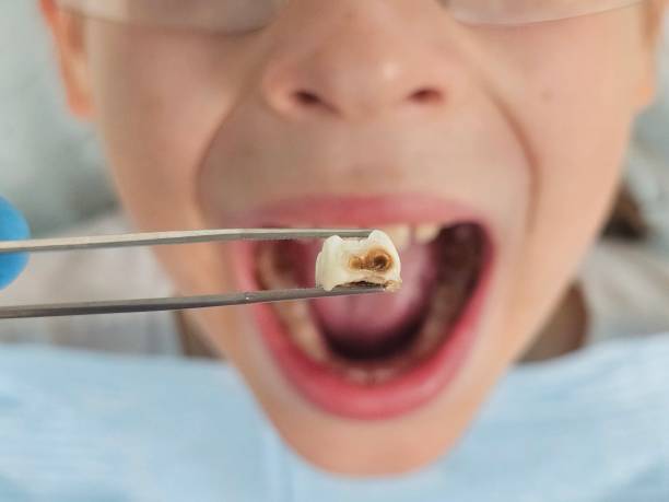 Best Cracked Tooth Emergency Dentist  in Violet, LA